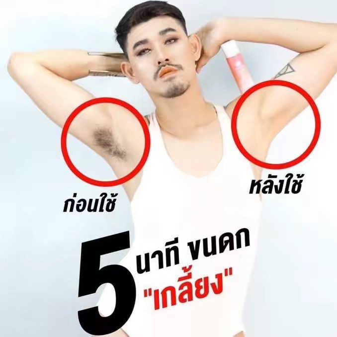 มูสเทพกำจัดขน 546