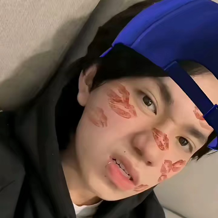 onic caaaa💛🦔🦔