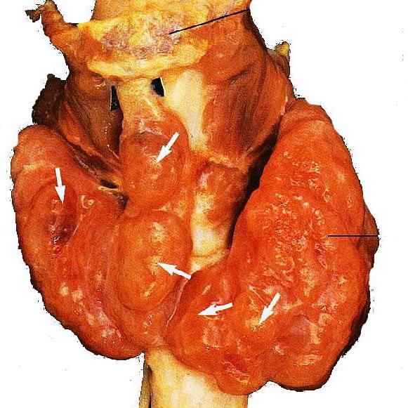 сердце защемило