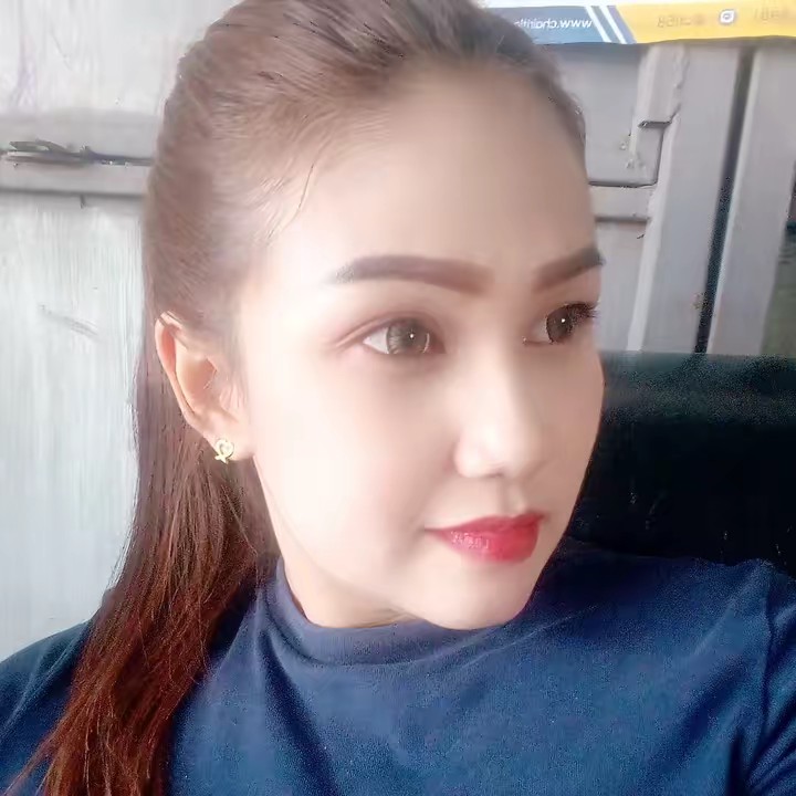 อังศุมา ยิ้มสู้กับ Sle.