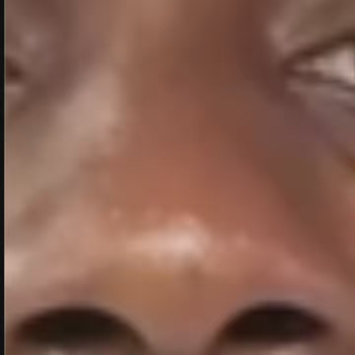 Osasioo’s Nose