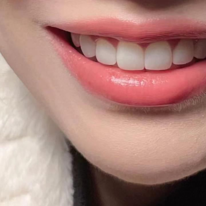 Love 💕teeth