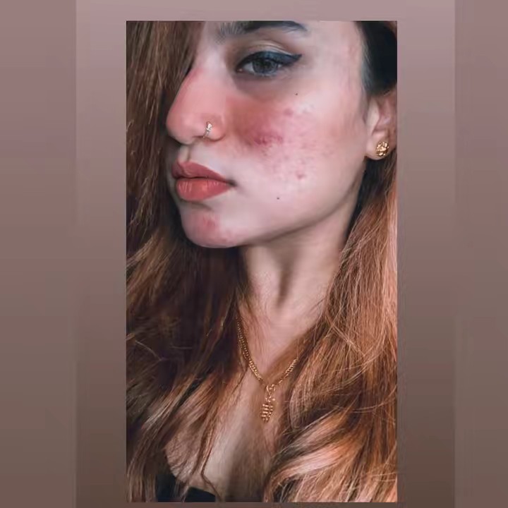 ❦𝐴𝑠ℎ𝑤𝑖𝑛𝑖𝑚𝑎𝑛𝑖𝑎𝑚❦