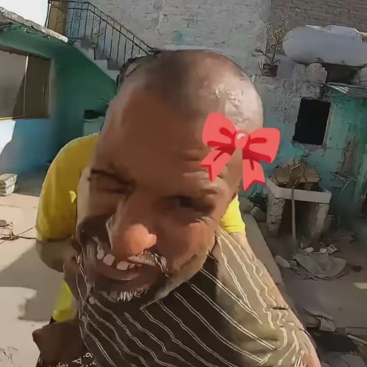 —••K_BB••—