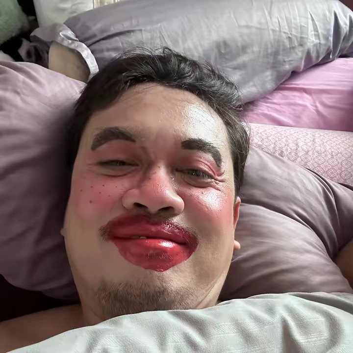 อ้ายป๊อปฟันบิ่น