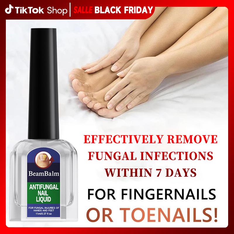 Maximum Strength Comprehensive Toenail Fungus Solution | Triple Action Formula Fights Fungus, Clears Yellow & Thick Nails, Fast Itch Relief.#SummerVibes