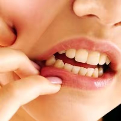 ยาสีฟันสมุนไพรแก้ปวดฟัน CF