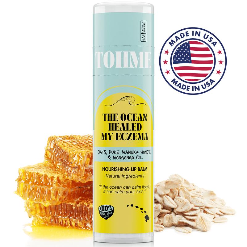 Nourishing Eczema Lip Balm with Ancient Mongongo Oil! Gentle, hydrating care for dry, cracked lips—perfect for sensitive skin. Moisture Skincare