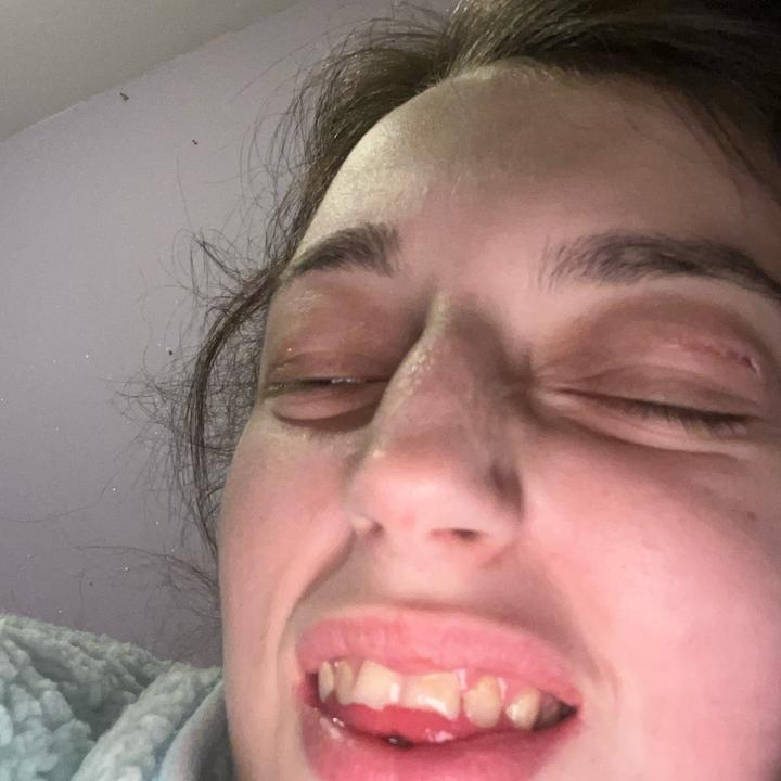 ⛄️ snowball yeah