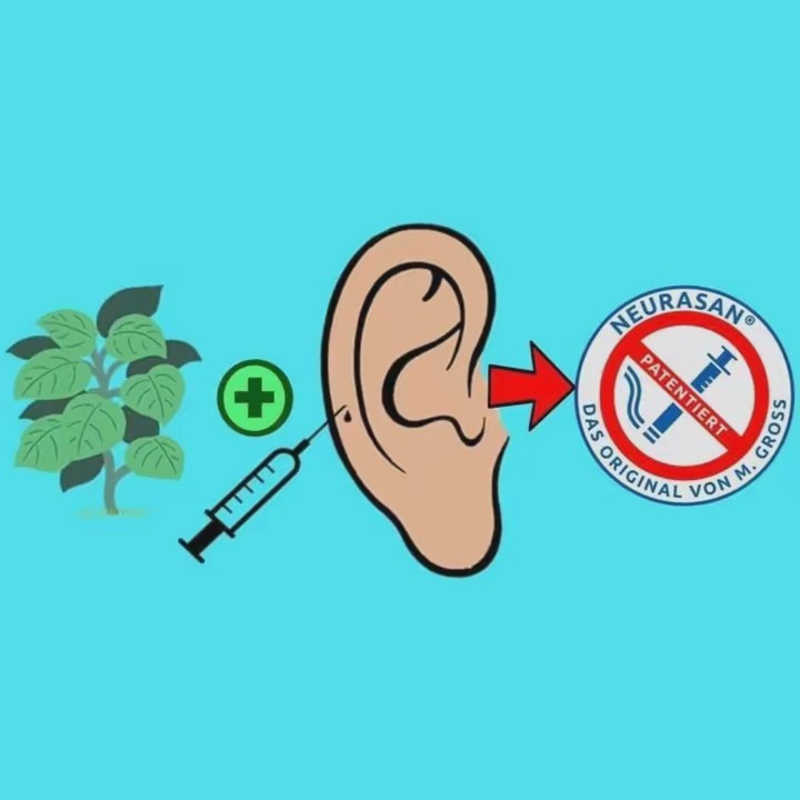 NeuraSan®