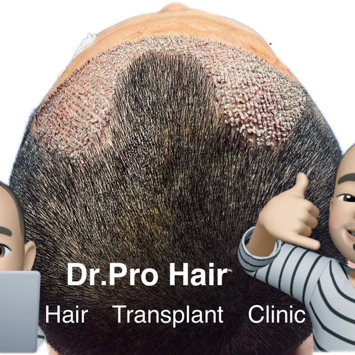 Dr.Kaung Myat Kyaw(Dr.Pro Hair