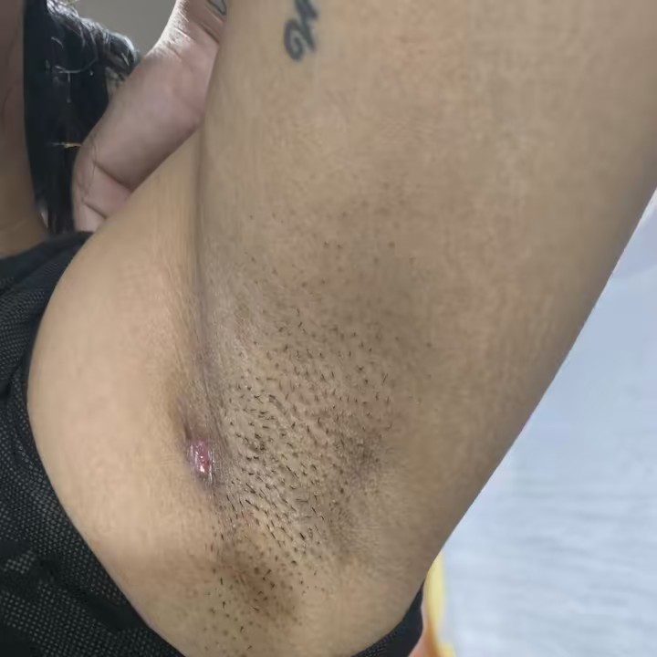 รักแร้ฉันต้องเนียน